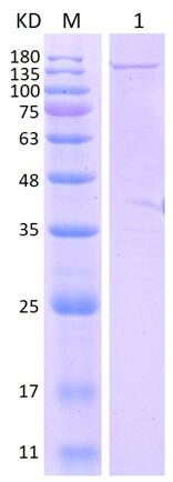 12% SDS-PAGE analysis profiles of purified NTHI0354-26-1392 (CBB stained).